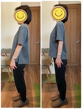 はた整体院/姿勢改善！