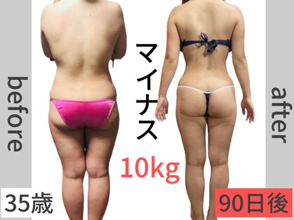 アーク(ARC)の写真