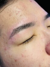 ハンサムモンスター(Handsome Monster)/眉毛脱毛