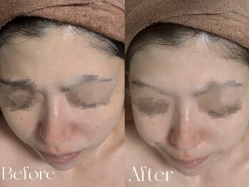 ウィハナ(wehana)/【セラピール】赤みケア/透明感