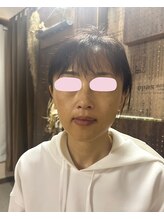 ナギスポット(Nagispot)/After