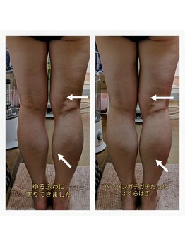 紬(TSUMUGI)/ガチガチパンパンのふくらはぎ