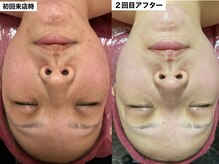 リベル(ReBelle.)/