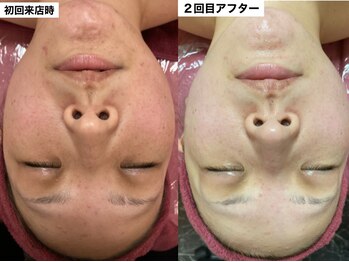 リベル(ReBelle.)/