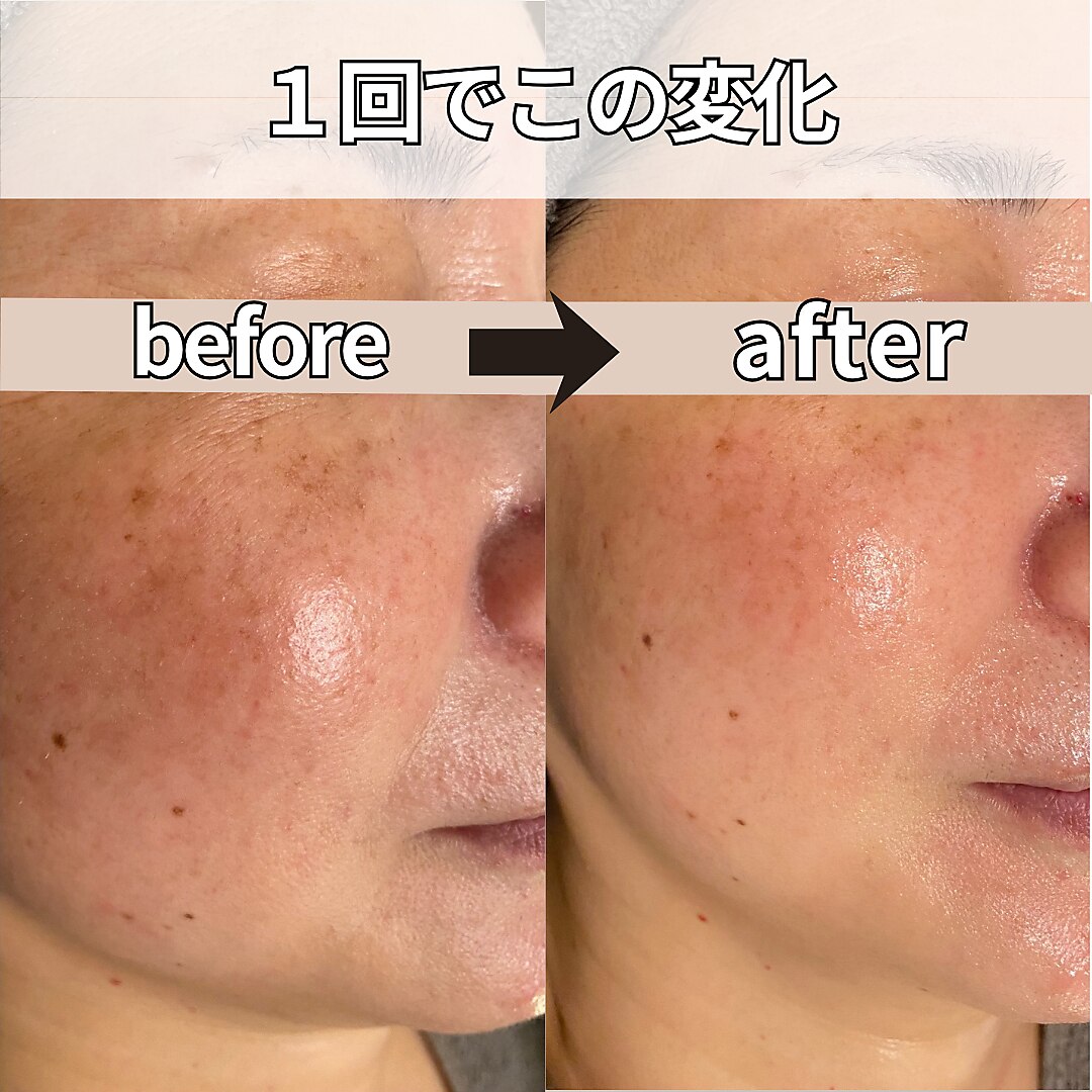モーイエンチャーム(mooi en charme)｜ホットペッパービューティー