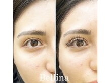 ベリーナ(Bellina)/