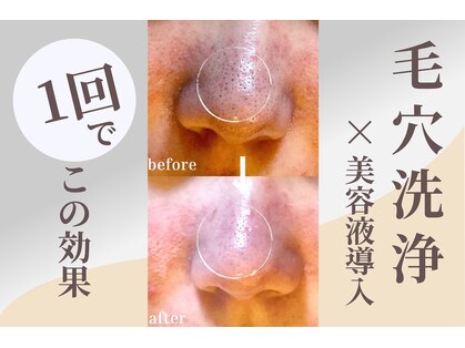 アイア(AIA)の写真