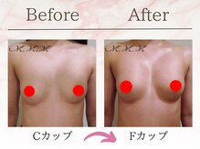 エムエムエム 表参道Luxeサロン(M.M.M)/【バストアップ例】　C→Fカップ