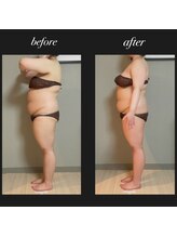 エヌボーテ(N. beaute)/before→after全身コース2回目