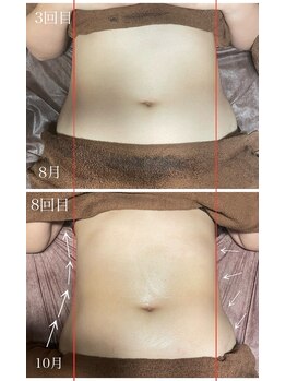 イーストモア(EAST MOIS)/綺麗なボディラインが出現！！