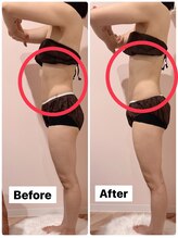 ルミナス 八尾店(Luminous)/痩身ビフォー・アフター