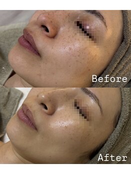 アテ 国分寺店(Ate)/剥離なし!でもトーンアップ