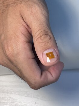 haruka nail × マイクロチップ