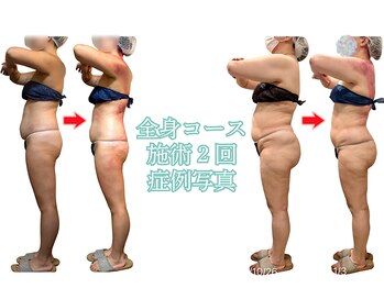 スピード美人 本八幡店