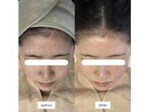 ブレデ フクオカ(B’lady Fukuoka)の雰囲気(マリムーブフェイシャルワックス公式認定サロン)