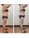 リンパサロン リ スタートの写真/食事制限なし、、運動、サプリ不要！リバウンドなし！辛い我慢のダイエットをやめたら－18kg達成！