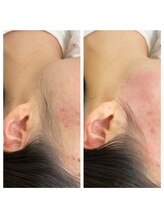 ヴェリー(Very)/もみあげワックス