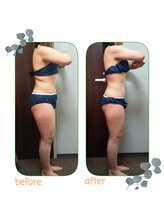 ダイエット サポート(DIET SUPPORT)/短期＆グロッティ　施術結果