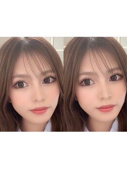 ボリュームのある目元にしたい
