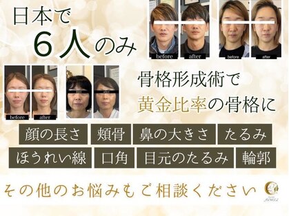 ユウェール(JUWEEL)の写真