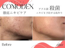 ビバディ(Vivady)/COMODEX