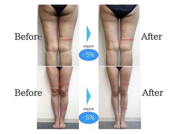 ミューズファクトリー(Muse factory)/ほっそり美脚を目指せる！