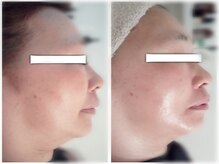 ホロホロ(holoholo)/頭蓋骨矯正&小顔矯正