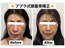 ブプラ 下関店(BUPURA)の雰囲気（業界初3TS法で、顔のラインも歪みもお肌の質感も劇的変化！）