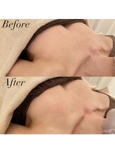 IBC 横浜馬車道店/BeafteafteAfter