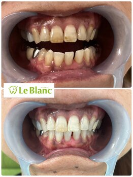 ルブラン 奈良店(Le Blanc)/白い歯で好印象!!