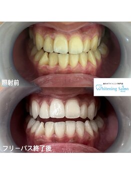 ホワイトニングサロン 熊本店/熊本ホワイトニング