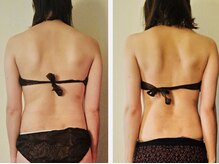 マナ(mana)/20代ブライダル痩身／美姿勢