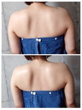 ミラクルバスト 松山店/ビフォーアフター１回施術