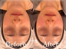 R-1ビューティーサロン 表参道/Before&After