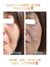 ヨサパーク ココワ(YOSA PARK Cocowa)/水素吸入→水素まみれコース