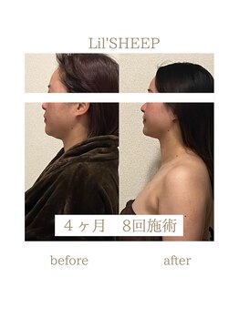 リルシープ(LIL'SHEEP)/