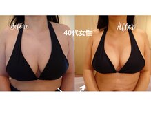 サロンハナ(Salon HANA)/40代女性5回のビフォーアフター