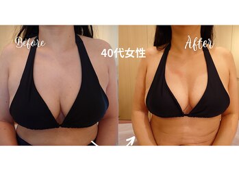 サロンハナ(Salon HANA)/40代女性5回のビフォーアフター