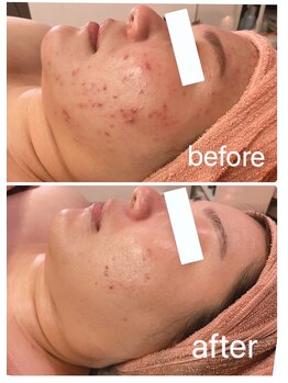 アルコイリス(Arco iris)/肌トラブルが気になる方へ