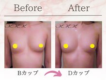 エムエムエム 表参道Luxeサロン(M.M.M)/【バストアップ例】　B→Dカップ