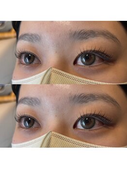 エス('S)/ニュアンスカール　メガCロッド