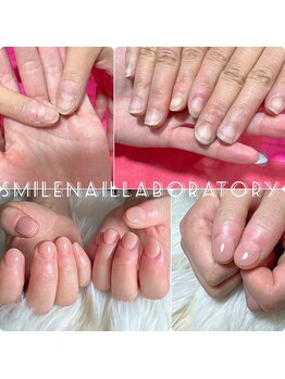 スマイル ネイル ラボラトリー(Smile nail laboratory)/地爪育成