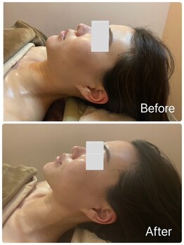 つかしんえいど/【エステ】プレミアム美顔コース