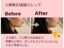 ピオニー(Peony)/Before & After
