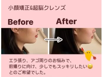 ピオニー(Peony)/Before & After