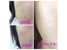 サロン ド ネイジュ(Salon de Neije)
