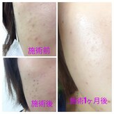 サロン ド ネイジュ(Salon de Neije)