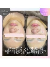 ビューティサロン ベルティア(Beltia)/#ダイエット#痩身#ブライダル