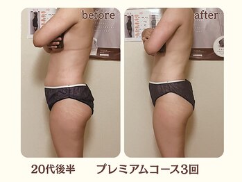 ヨサパーク ハーブ イムア(YOSA PARK imua)/◎お客様の変化