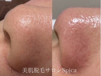 スピカ(SPICA)/鼻の黒いポツポツ実は毛かも!